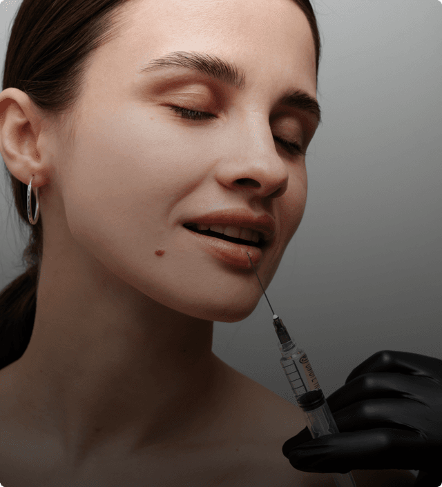 Lip Filler