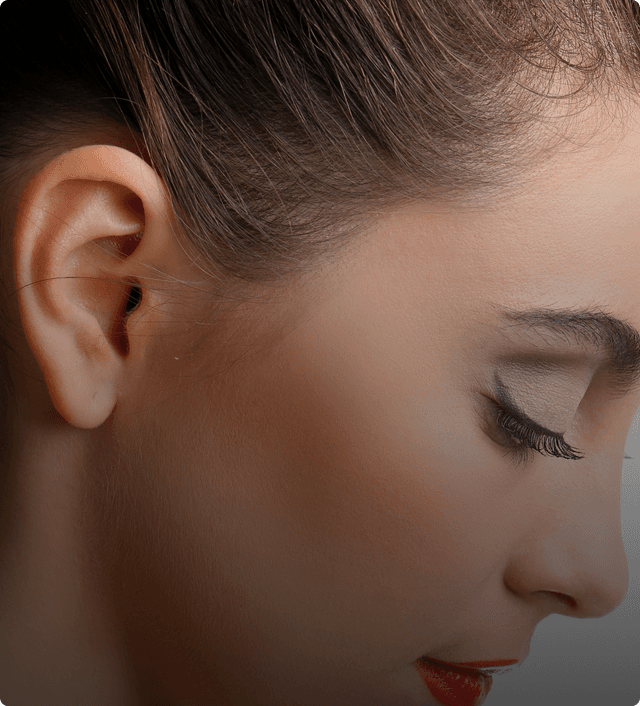 Otoplasty