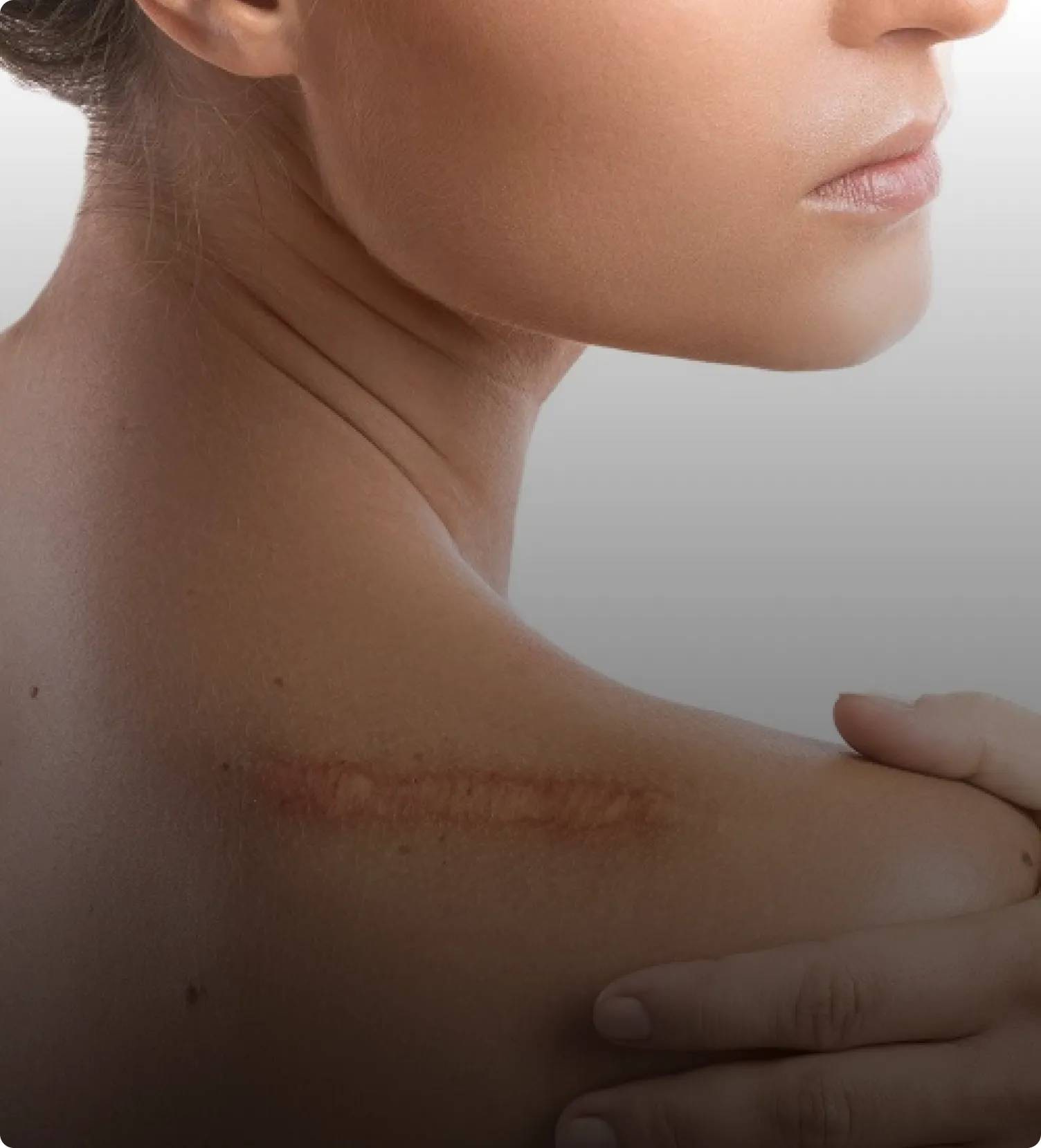 Keloid Treatment in Malaysia
