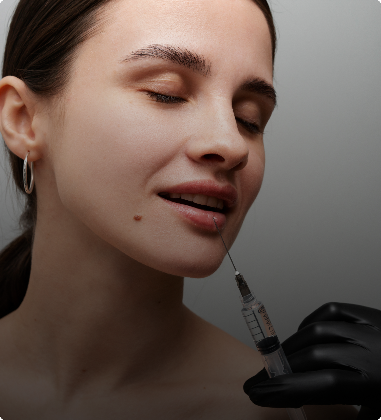 Lip Filler