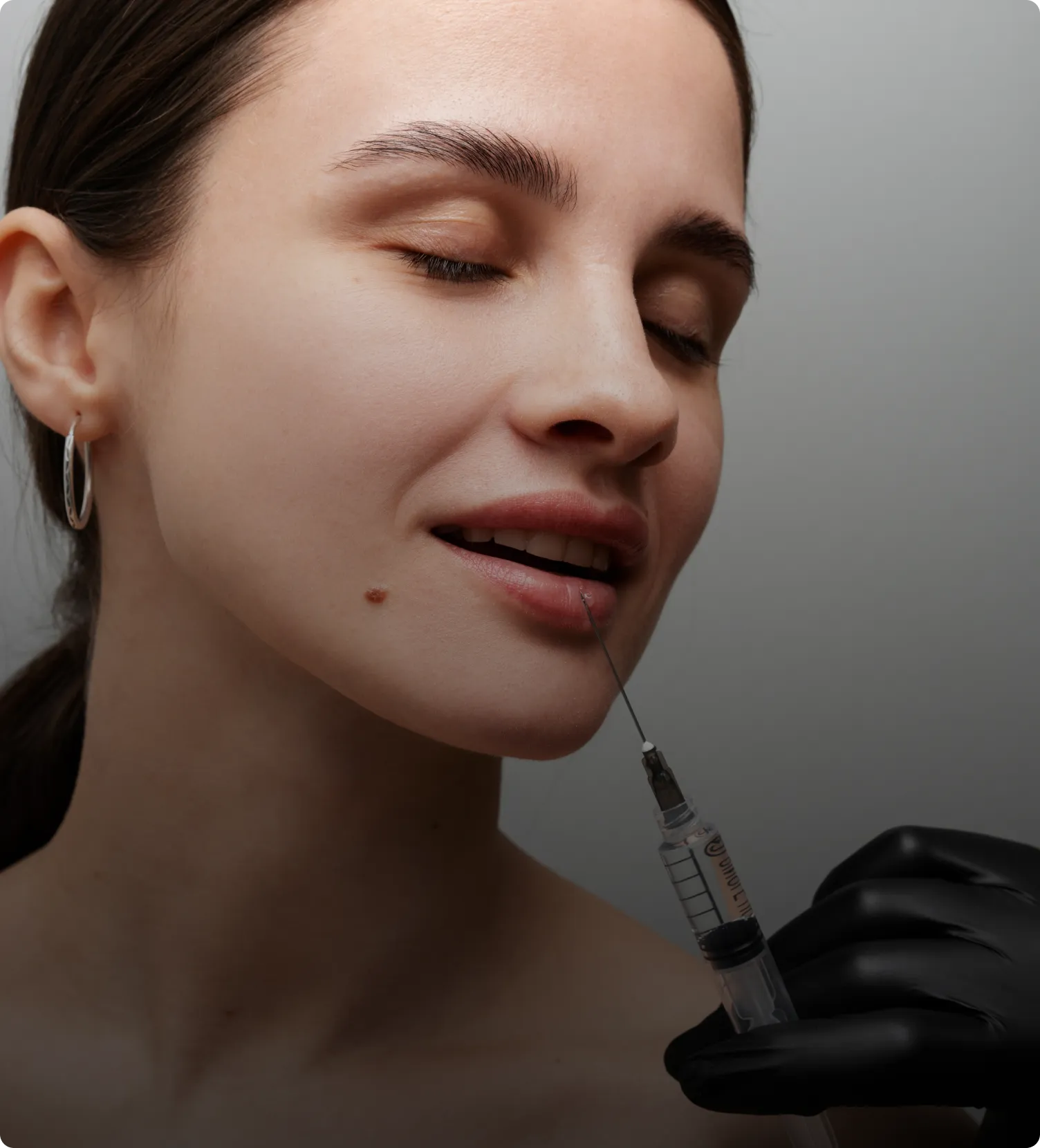 Lip Filler in Malaysia